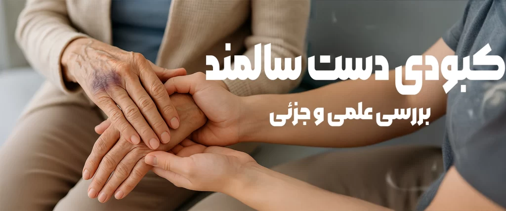 کبودی دست سالمند
